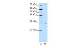 ATOH8 Rabbit anti-Human, Polyclonal, Novus Biologicals 0.1ml; Unconjugated:Antibodies,